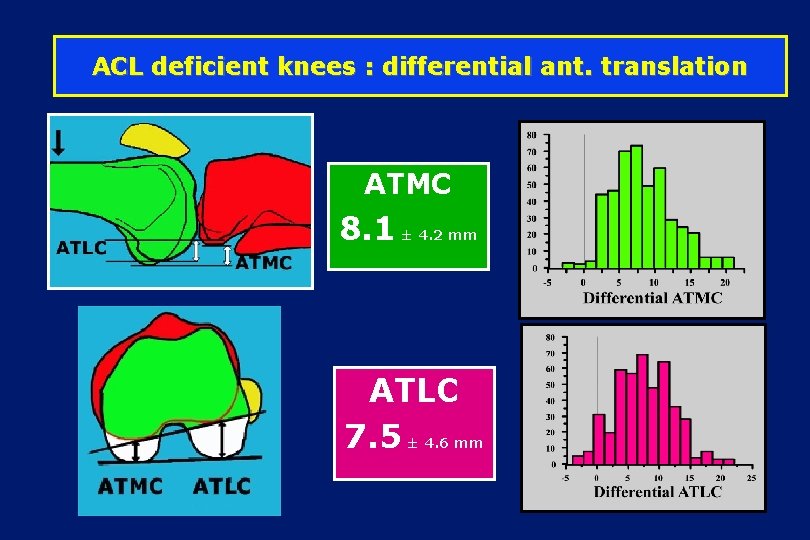 ACL deficient knees : differential ant. translation ATMC 8. 1 ± 4. 2 mm