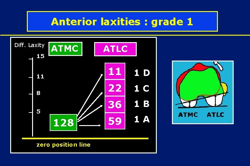 Anterior laxities : grade 1 Diff. Laxity 15 ATMC 11 8 5 128 zero