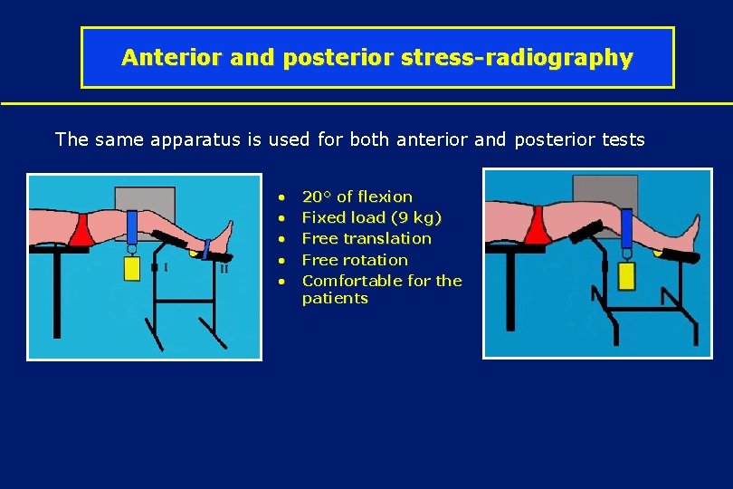 Anterior and posterior stress-radiography The same apparatus is used for both anterior and posterior