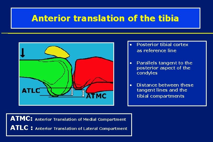 Anterior translation of the tibia • Posterior tibial cortex as reference line • •