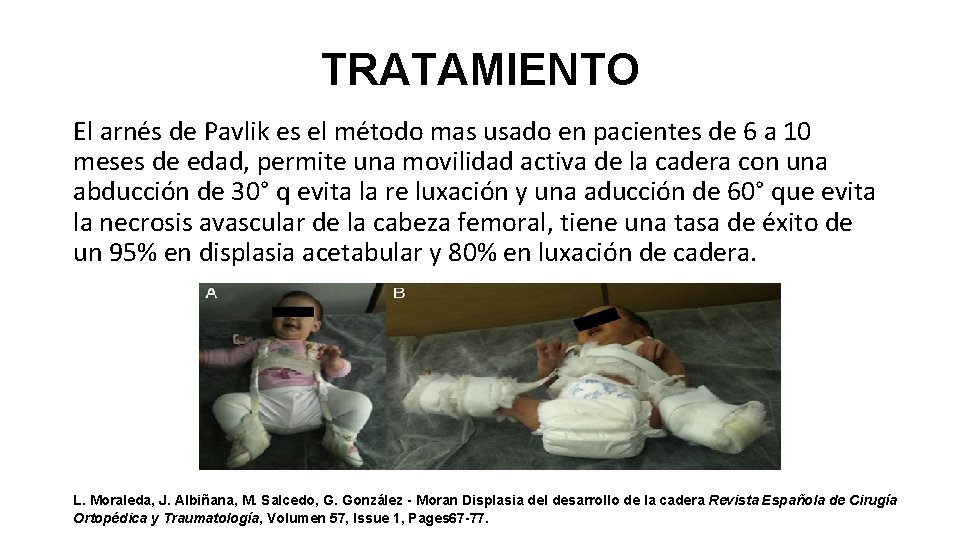 TRATAMIENTO El arnés de Pavlik es el método mas usado en pacientes de 6