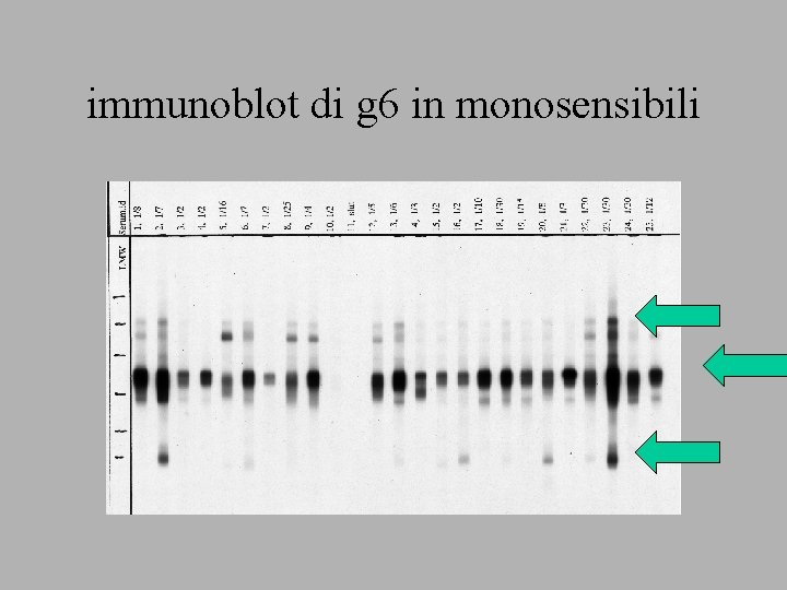 immunoblot di g 6 in monosensibili 