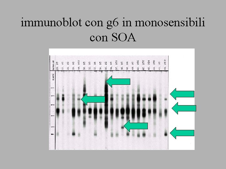 immunoblot con g 6 in monosensibili con SOA 