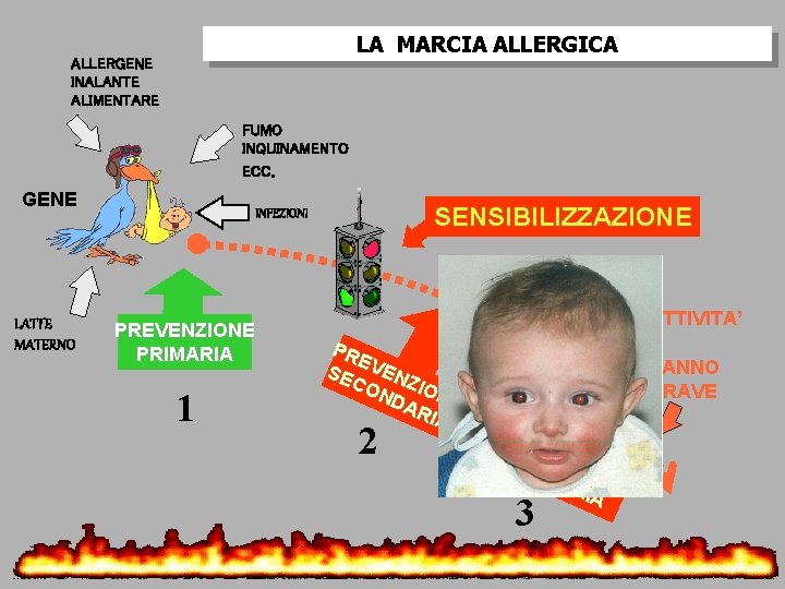 LA MARCIA ALLERGICA ALLERGENE INALANTE ALIMENTARE FUMO INQUINAMENTO ECC. GENE SENSIBILIZZAZIONE INFEZIONI INFIAMMAZIONE LATTE