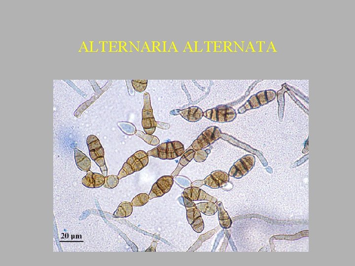 ALTERNARIA ALTERNATA 