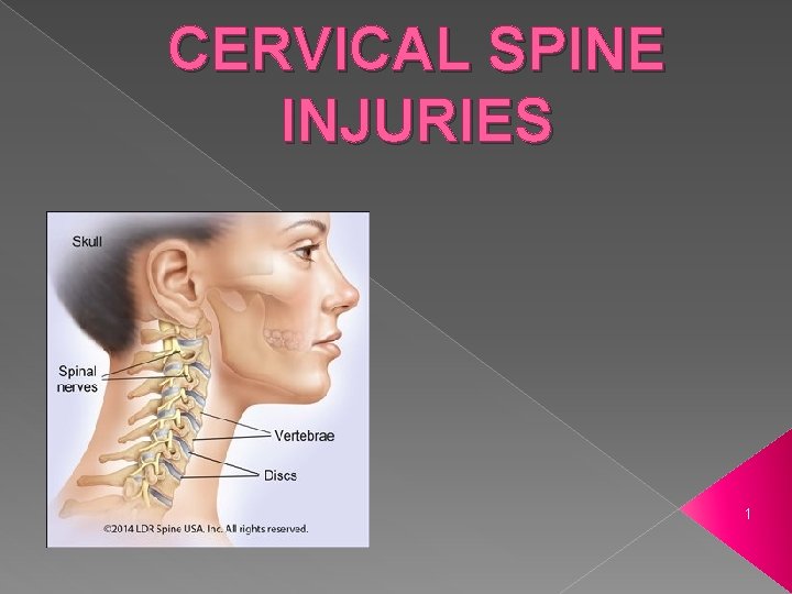 CERVICAL SPINE INJURIES 1 