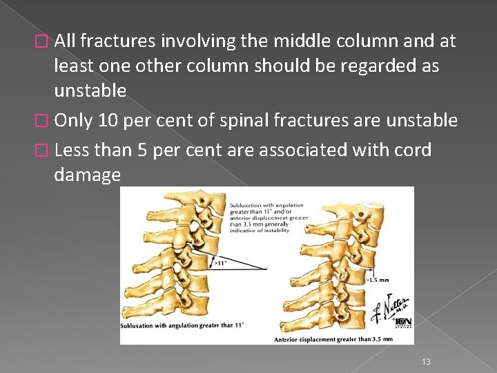 � All fractures involving the middle column and at least one other column should