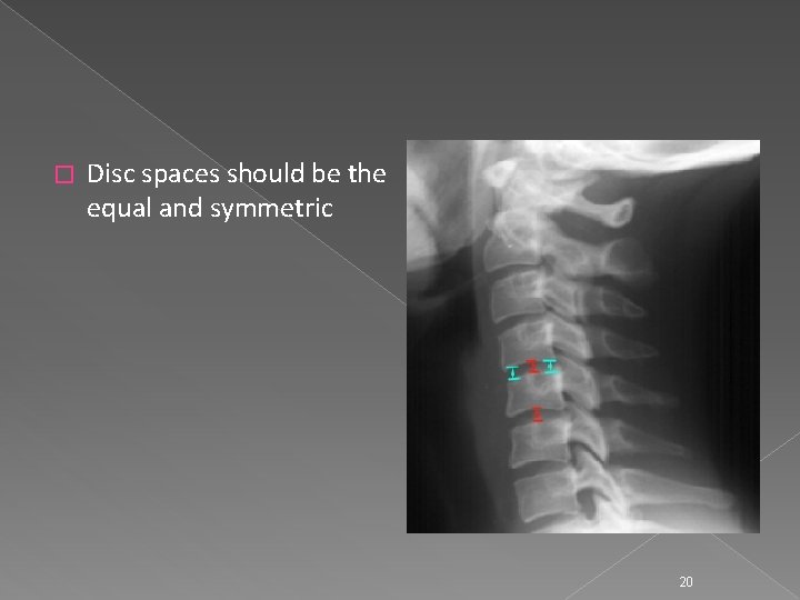 � Disc spaces should be the equal and symmetric 20 