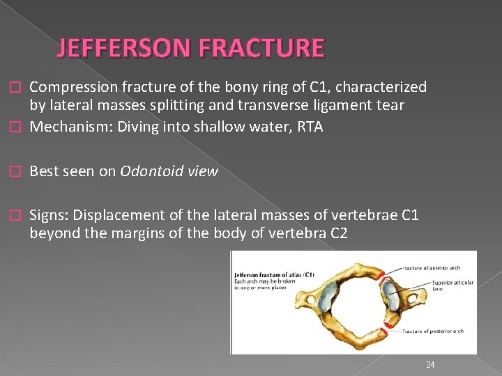 JEFFERSON FRACTURE Compression fracture of the bony ring of C 1, characterized by lateral