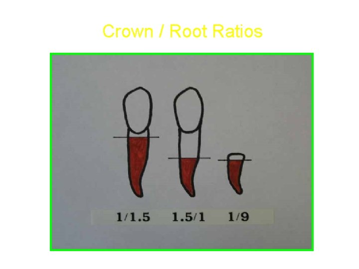 Crown / Root Ratios 