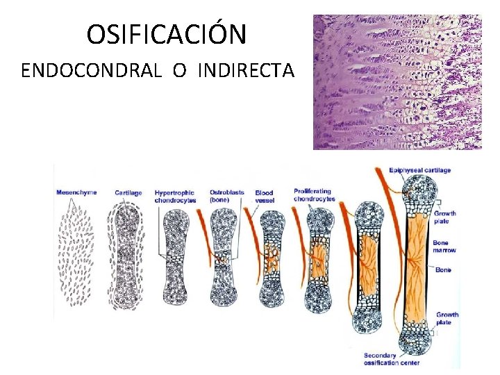 OSIFICACIÓN ENDOCONDRAL O INDIRECTA 