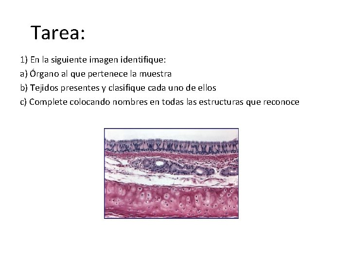 Tarea: 1) En la siguiente imagen identifique: a) Órgano al que pertenece la muestra