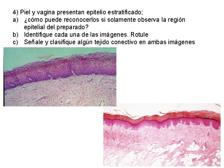 4) Piel y vagina presentan epitelio estratificado; a) ¿cómo puede reconocerlos si solamente observa