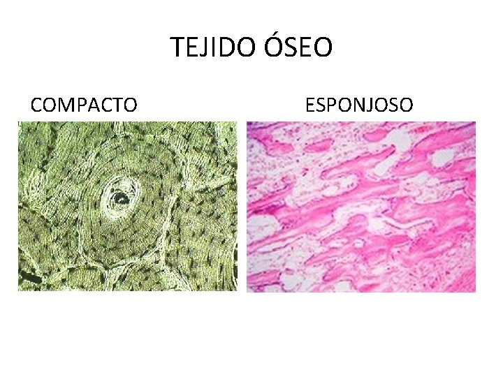 TEJIDO ÓSEO COMPACTO ESPONJOSO 