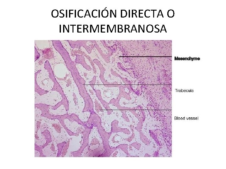 OSIFICACIÓN DIRECTA O INTERMEMBRANOSA 