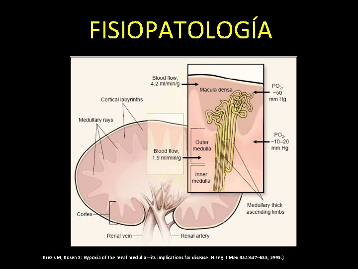 FISIOPATOLOGÍA Brezis M, Rosen S: Hypoxia of the renal medulla—its implications for disease. N