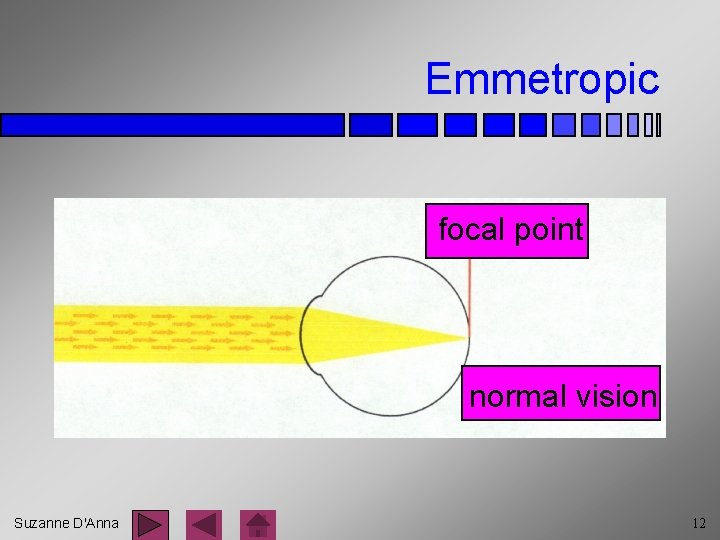 Emmetropic focal point normal vision Suzanne D'Anna 12 