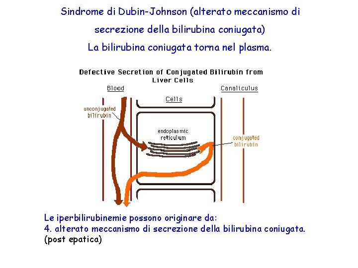 Sindrome di Dubin-Johnson (alterato meccanismo di secrezione della bilirubina coniugata) La bilirubina coniugata torna