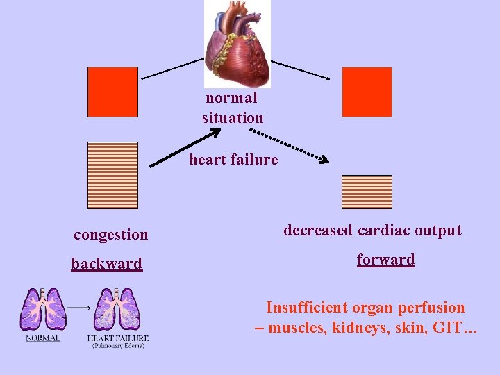 normal situation heart failure congestion backward decreased cardiac output forward Insufficient organ perfusion –