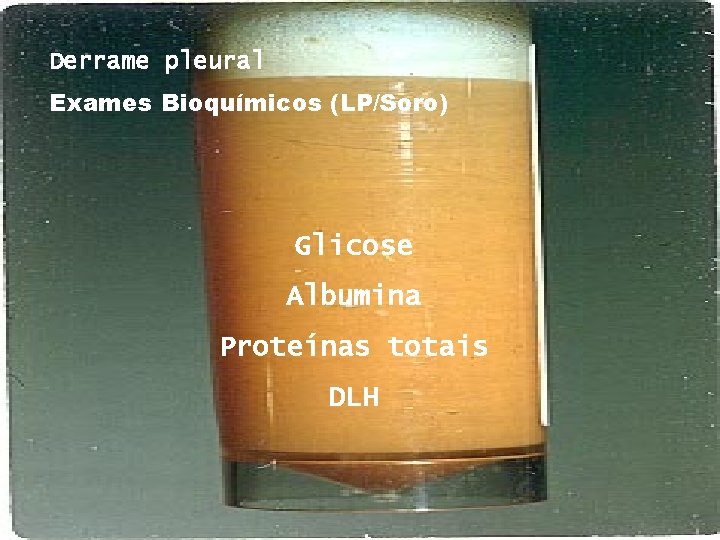 Derrame pleural Exames Bioquímicos (LP/Soro) Glicose Albumina Proteínas totais DLH 