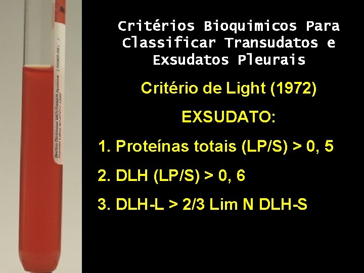 Critérios Bioquimicos Para Classificar Transudatos e Exsudatos Pleurais Critério de Light (1972) EXSUDATO: 1.