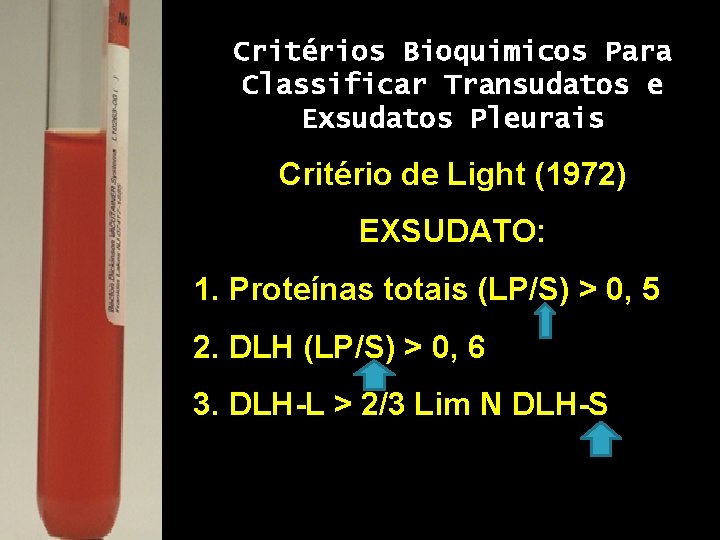 Critérios Bioquimicos Para Classificar Transudatos e Exsudatos Pleurais Critério de Light (1972) EXSUDATO: 1.