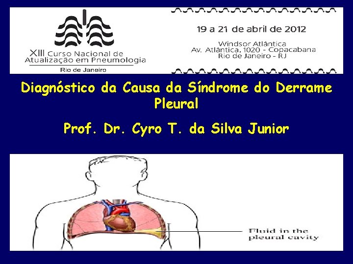 Diagnóstico da Causa da Síndrome do Derrame Pleural Prof. Dr. Cyro T. da Silva