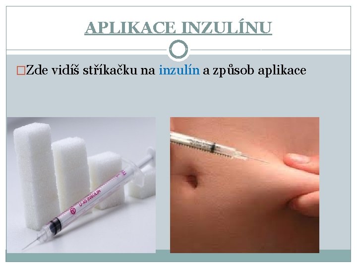 APLIKACE INZULÍNU �Zde vidíš stříkačku na inzulín a způsob aplikace 