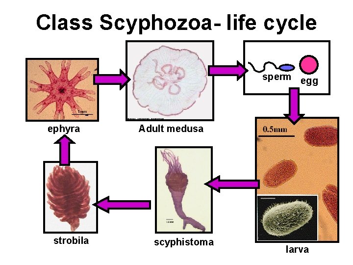 Class Scyphozoa- life cycle sperm egg ephyra strobila Adult medusa scyphistoma larva 