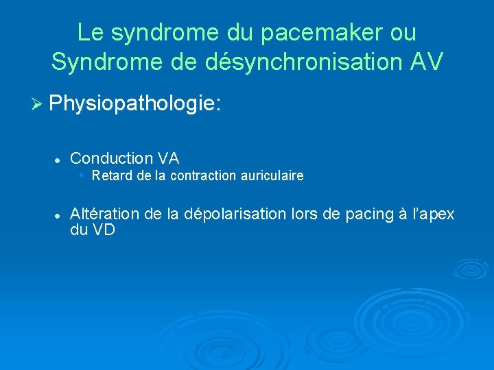 Le syndrome du pacemaker ou Syndrome de désynchronisation AV Ø Physiopathologie: l Conduction VA