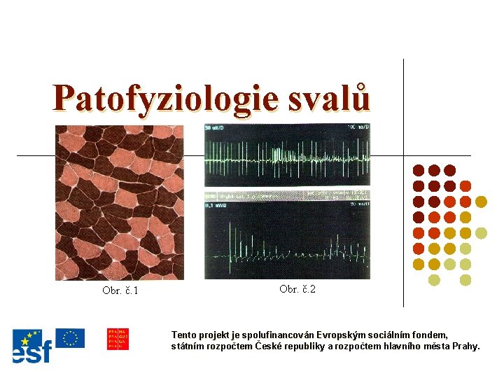 Patofyziologie svalů Obr. č. 1 Obr. č. 2 Tento projekt je spolufinancován Evropským sociálním