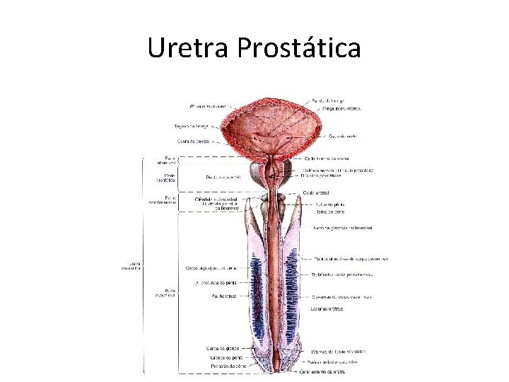 Uretra Prostática 