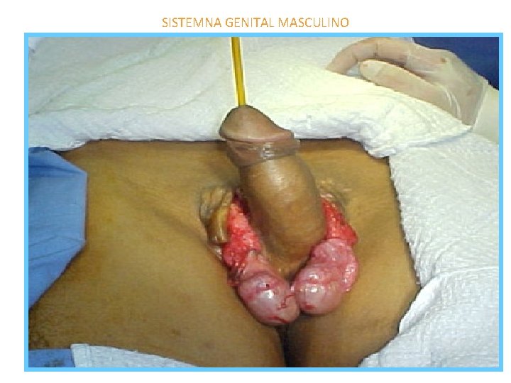 SISTEMNA GENITAL MASCULINO SISTEMNA GENITAL MASCULINO