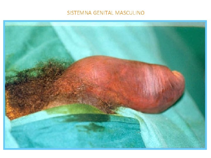 SISTEMNA GENITAL MASCULINO 