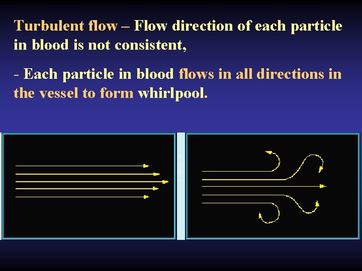 Turbulent flow – Flow direction of each particle in blood is not consistent, -