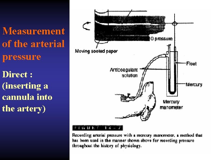 Measurement of the arterial pressure Direct : (inserting a cannula into the artery) 