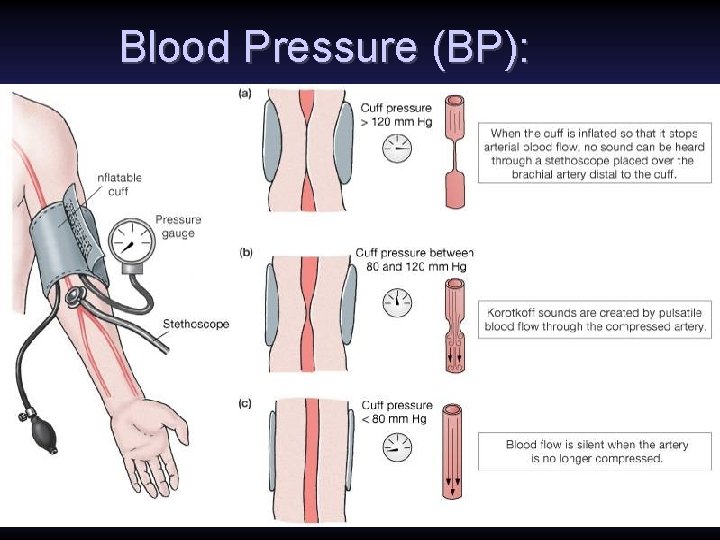 Blood Pressure (BP): 