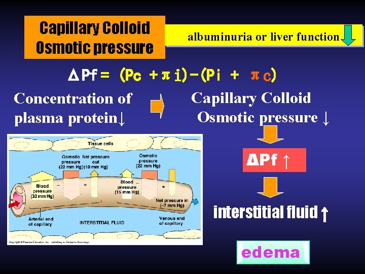 Capillary Colloid Osmotic pressure albuminuria or liver function ΔPf = (Pc +πi)-(Pi + πc)