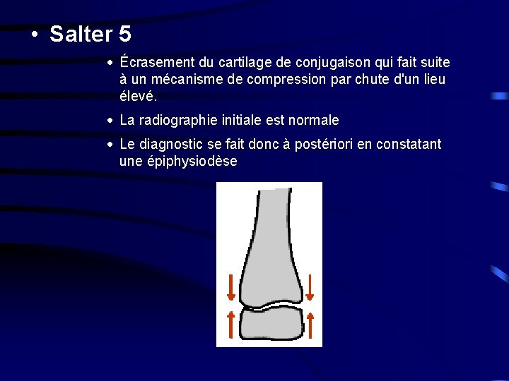  • Salter 5 · Écrasement du cartilage de conjugaison qui fait suite à