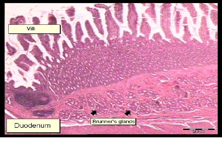  • Submucosal glands – Brunner’s gland 