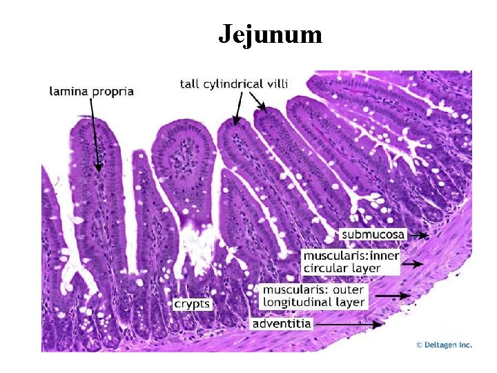 Jejunum 