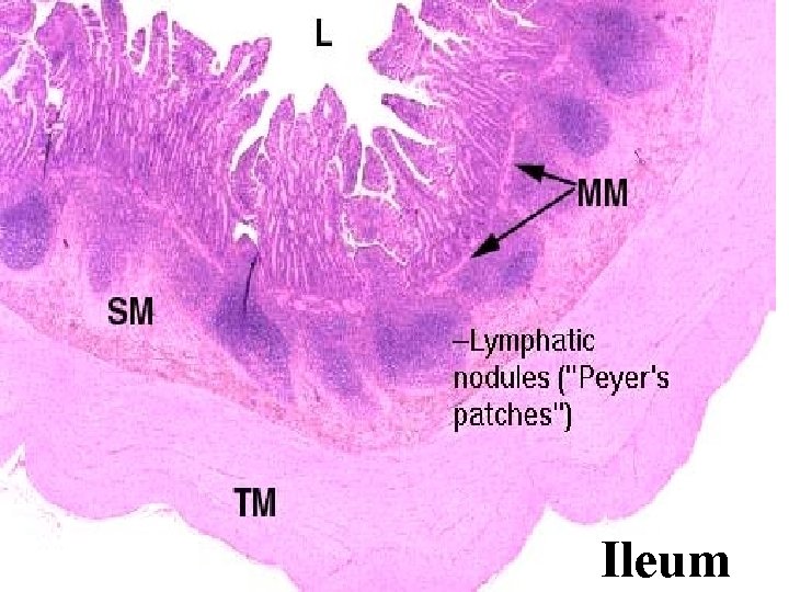 Ileum 