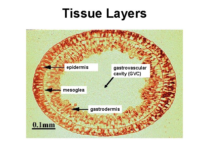 Tissue Layers epidermis gastrovascular cavity (GVC) mesoglea gastrodermis 
