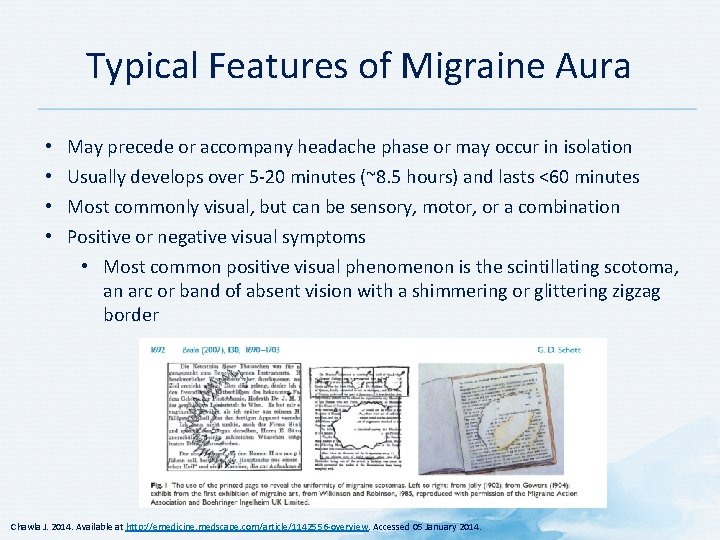 Typical Features of Migraine Aura • • May precede or accompany headache phase or Typical Features of Migraine Aura • • May precede or accompany headache phase or