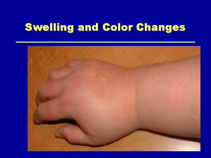 Swelling and Color Changes 