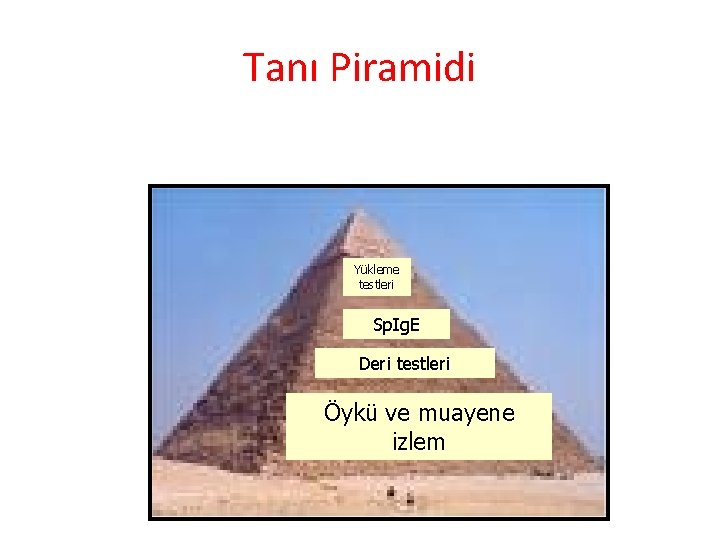 Tanı Piramidi Yükleme testleri Sp. Ig. E Deri testleri Öykü ve muayene izlem 