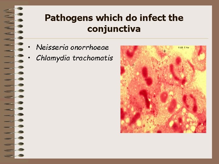 Pathogens which do infect the conjunctiva • Neisseria onorrhoeae • Chlamydia trachomatis 