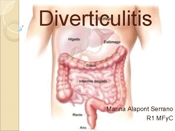 Diverticulitis Marina Alapont Serrano R 1 MFy. C 