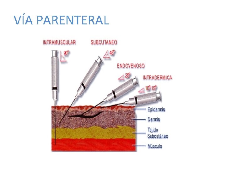VÍA PARENTERAL 