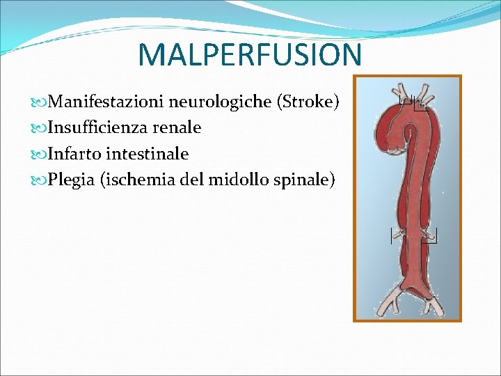 MALPERFUSION Manifestazioni neurologiche (Stroke) Insufficienza renale Infarto intestinale Plegia (ischemia del midollo spinale) 